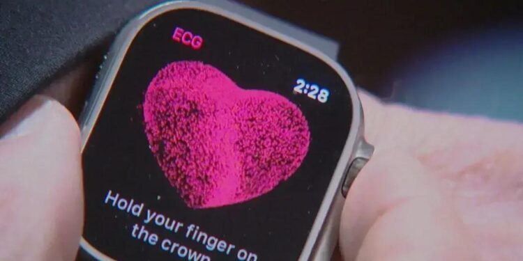 Estudo da Apple Revela Novo Modelo para Análise da Saúde dos Usuários